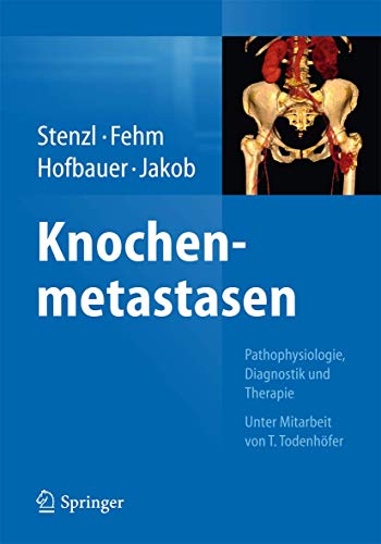 Bone metastases by Arnulf Stenzl ISBN 9783662434703