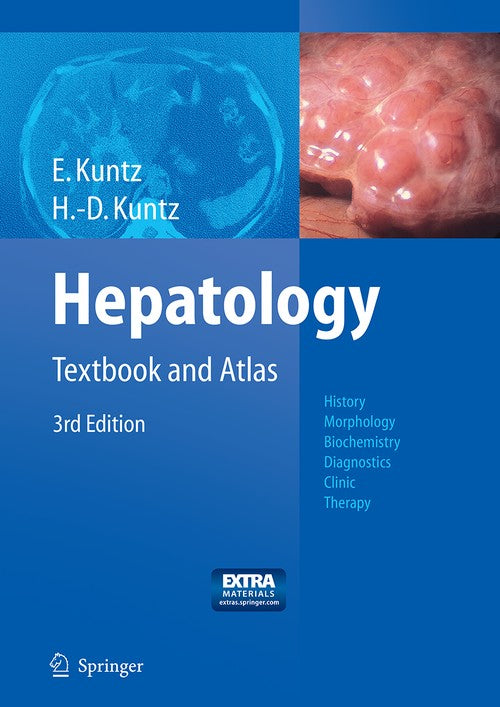 Hepatology by Erwin Kuntz | ISBN-13 9783662499702