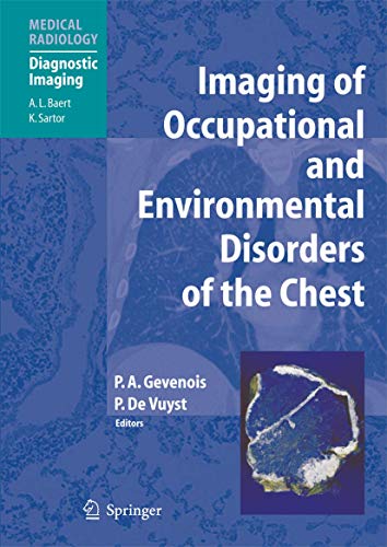 Imaging of Occupational and Environmental Disorders of the Chest by Pierre Alain Gevenois | ISBN-13 9783662500149
