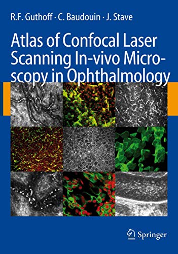 Atlas of Confocal Laser Scanning In-vivo Microscopy in Ophthalmology by Rf Guthoff | ISBN-13 9783662500613