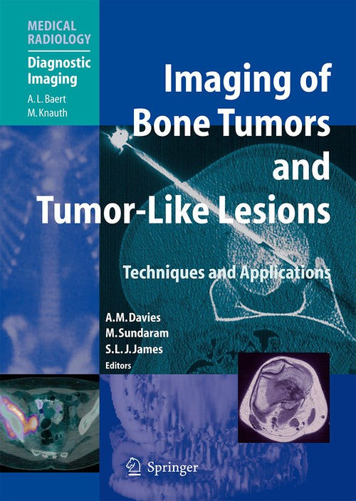 Imaging of Bone Tumors and Tumor-Like Lesions by A Mark Davies | ISBN-13 9783662501634