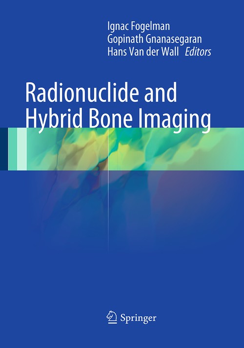 Radionuclide and Hybrid Bone Imaging by Ignac Fogelman | ISBN-13 9783662505687
