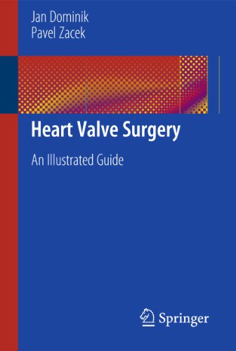 Heart Valve Surgery by Jan Dominik | ISBN-13 9783662505717
