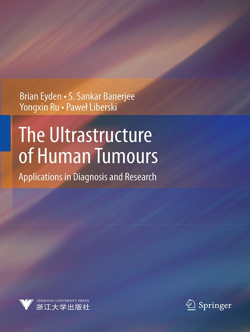 The Ultrastructure of Human Tumours by Brian Eyden | ISBN-13 9783662506905
