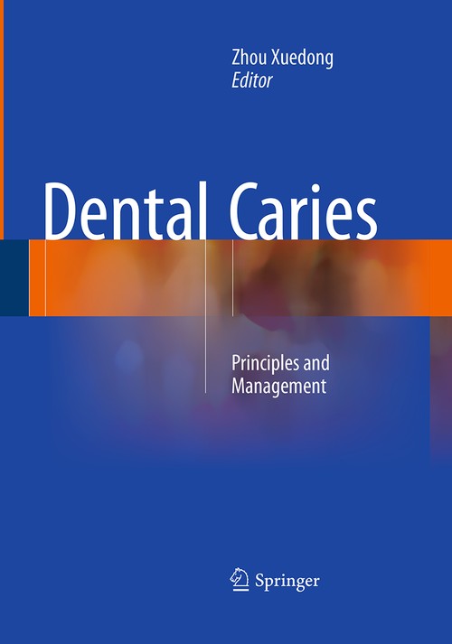 Dental Caries by Zhou Xuedong | ISBN-13 9783662510452
