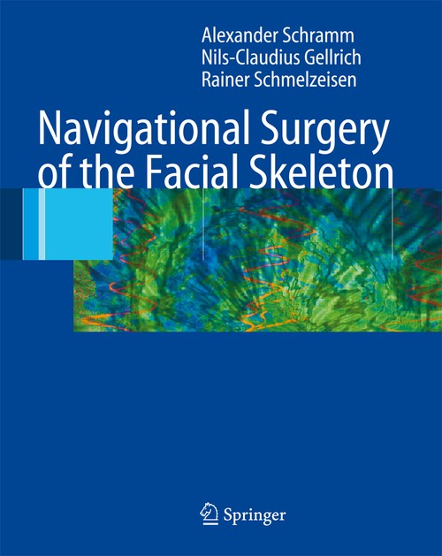 Navigational Surgery of the Facial Skeleton by Alexander Schramm | ISBN-13 9783662517642
