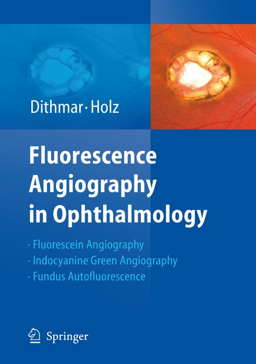 Fluorescence Angiography in Ophthalmology by Stefan Dithmar | ISBN-13 9783662517918
