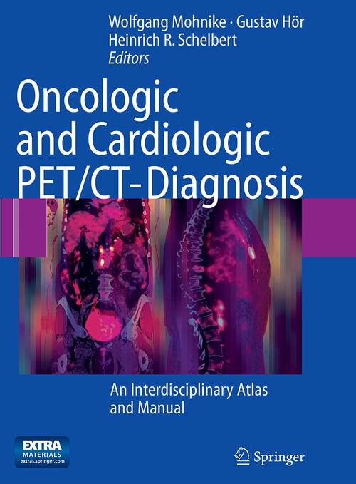 Oncologic and Cardiologic PET/CT-Diagnosis by Wolfgang Mohnike | ISBN-13 9783662518441