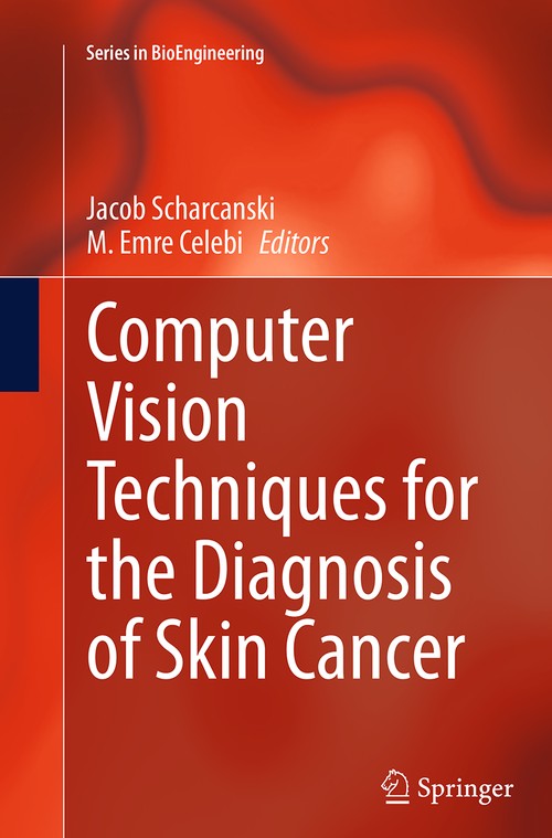 Computer Vision Techniques for the Diagnosis of Skin Cancer by Jacob Scharcanski | ISBN-13 9783662522622