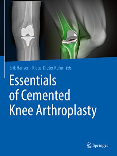 Essentials of Cemented Knee Arthroplasty by Erik Hansen ISBN 9783662631157