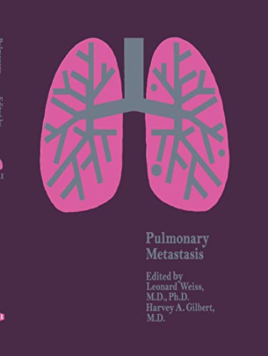 Pulmonary Metastasis by L Weiss | ISBN-13 9789024721573