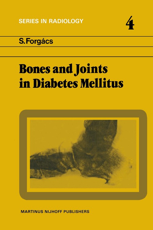 Bones and Joints in Diabetes Mellitus by S Forgcs | ISBN-13 9789024723959