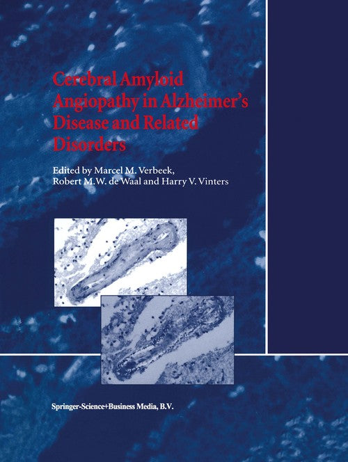 Cerebral Amyloid Angiopathy in Alzheimer’s Disease and Related Disorders by Mm Verbeek | ISBN-13 9789048154807
