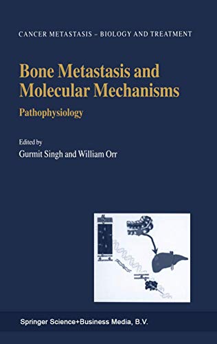Bone Metastasis and Molecular Mechanisms by Gurmit Singh | ISBN-13 9789048165636