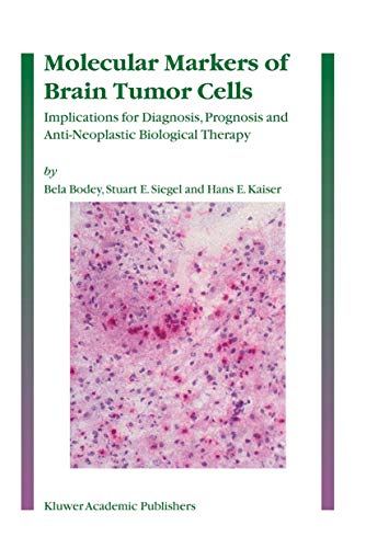 Molecular Markers of Brain Tumor Cells by Bela Bodey | ISBN-13 9789048167210