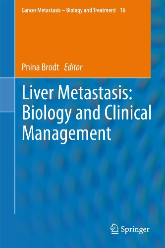 Liver Metastasis: Biology and Clinical Management by Pnina Brodt | ISBN-13 9789400735453