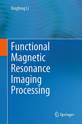 Functional Magnetic Resonance Imaging Processing by Xingfeng Li | ISBN-13 9789400773011