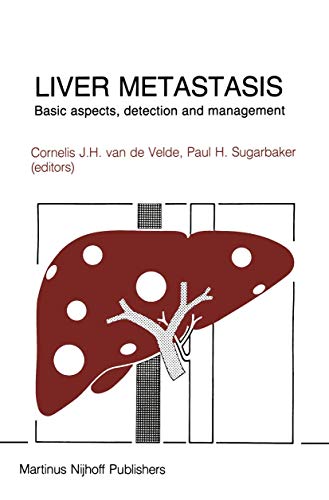 Liver Metastasis by Cornelis Van De Velde | ISBN-13 9789400960534