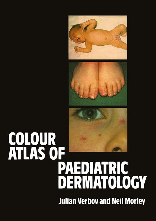 Colour Atlas of Paediatric Dermatology by J Verbov | ISBN-13 9789400973398