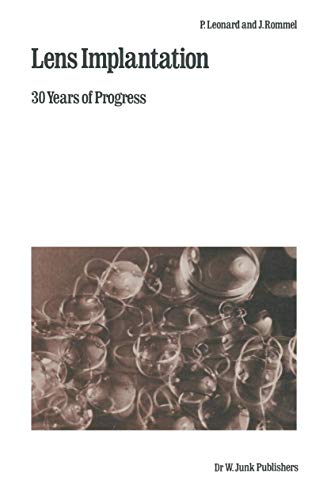 Lens Implantation by P Leonard | ISBN-13 9789400980204