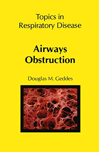 Airways Obstruction by Dm Geddes | ISBN-13 9789400980808