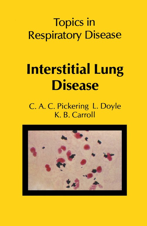 Interstitial Lung Disease by Cac Pickering | ISBN-13 9789400980860