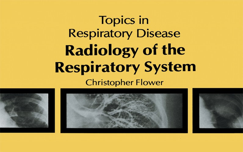 Radiology of the Respiratory System by Cdr Flower | ISBN-13 9789400980921