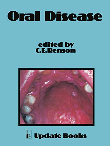 Oral Disease by Ce Renson | ISBN-13 9789400987715