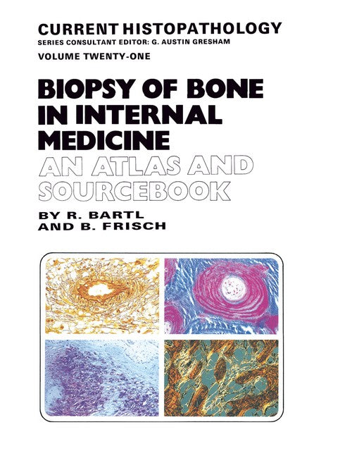 Biopsy of Bone in Internal Medicine: An Atlas and Sourcebook by Reiner Bartl | ISBN-13 9789401049856