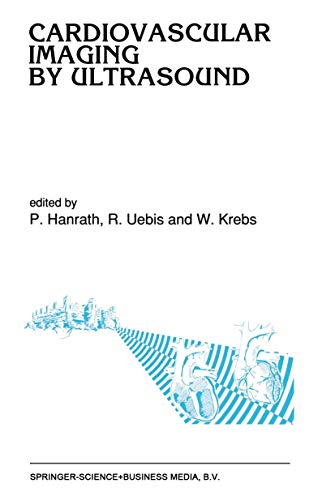 Cardiovascular Imaging by Ultrasound by Peter Hanrath | ISBN-13 9789401050982