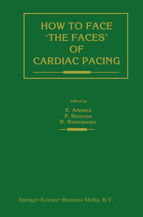 How to face 'the faces' of CARDIAC PACING by Erik Andries | ISBN-13 9789401051392