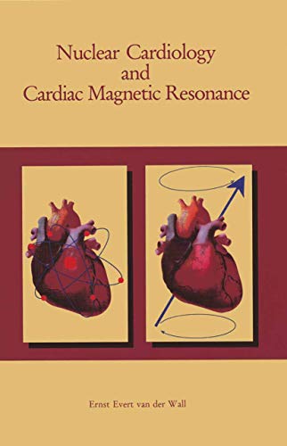Nuclear Cardiology and Cardiac Magnetic Resonance by Ernst E Van Der Wall | ISBN-13 9789401052566