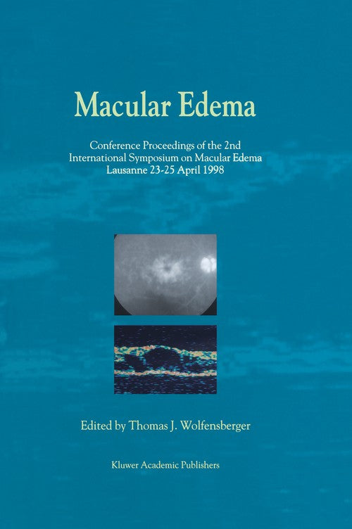Macular Edema by Thomas J Wolfensberger | ISBN-13 9789401058100
