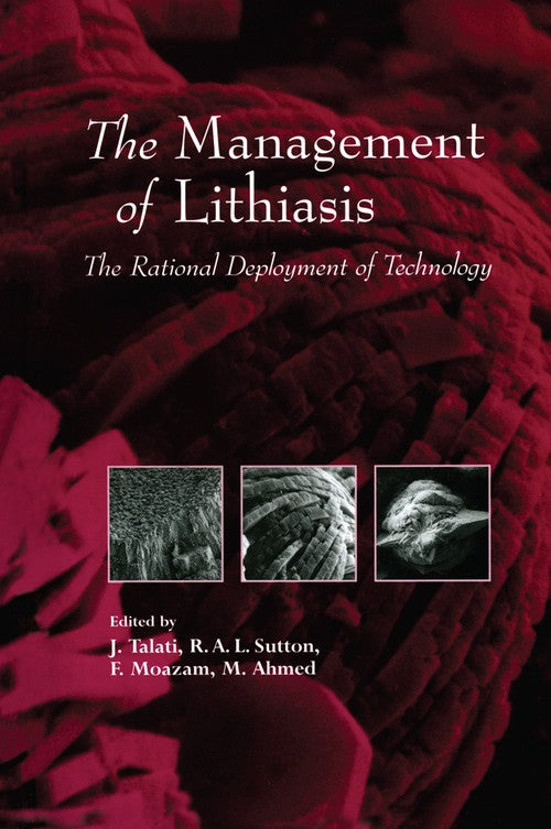 The Management of Lithiasis by Jamsheer J Talati | ISBN-13 9789401062701