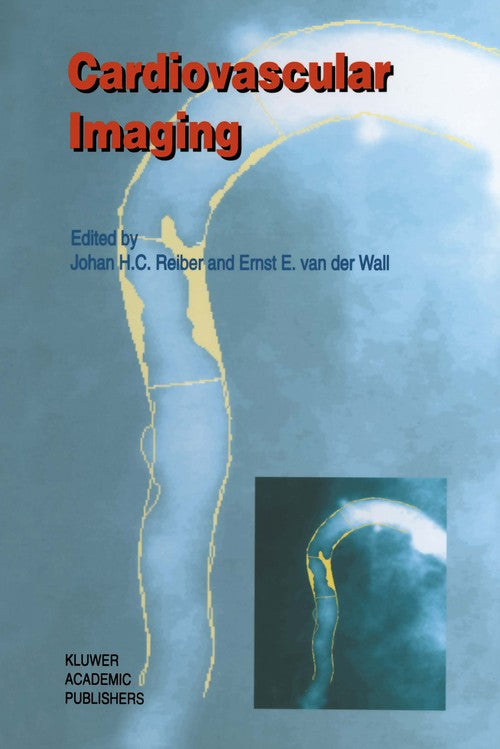 Cardiovascular Imaging by Johan H C Reiber | ISBN-13 9789401066167