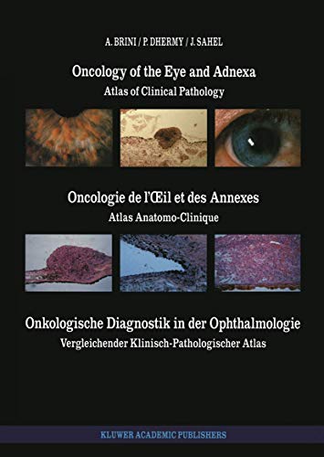 Oncology of the Eye and Adnexa / Oncologie de l’Œil et des Annexes / Onkologische Diagnostik in der Ophthalmologie by A Brini | ISBN-13 9789401066921