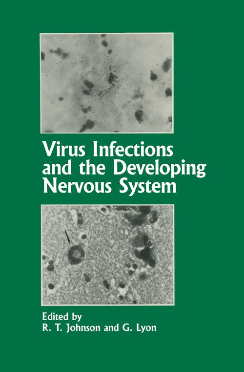 Virus Infections and the Developing Nervous System by Rt Johnson | ISBN-13 9789401070515