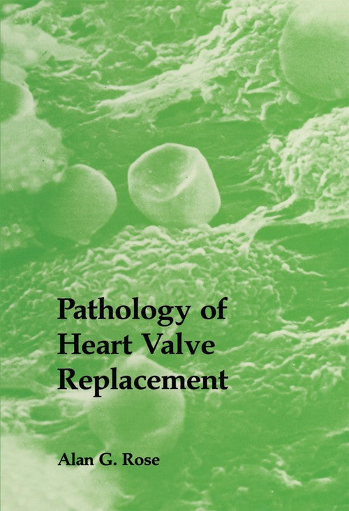 Pathology of Heart Valve Replacement by Ag Rose | ISBN-13 9789401079488