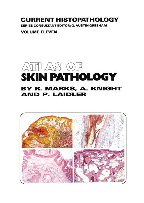 Atlas of Skin Pathology by Rm Marks ISBN 9789401083300