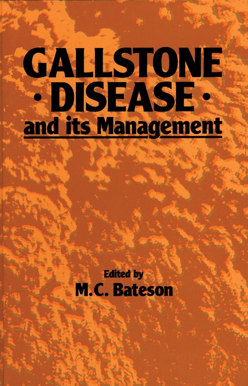 Gallstone Disease and its Management by Mc Bateson | ISBN-13 9789401083539