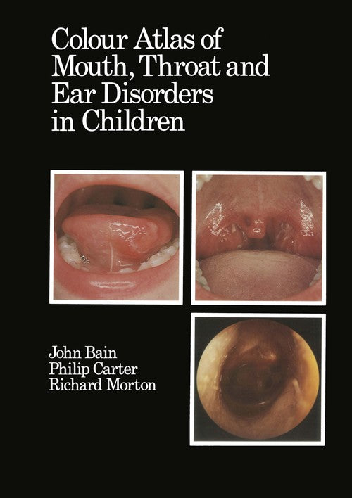 Colour Atlas of Mouth, Throat and Ear Disorders in Children by Dj Bain | ISBN-13 9789401086622