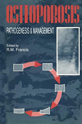 Osteoporosis by Rm Francis | ISBN-13 9789401095822