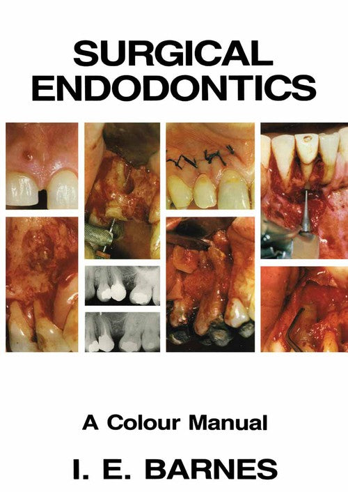 Surgical Endodontics by I Barnes ISBN 9789401098182