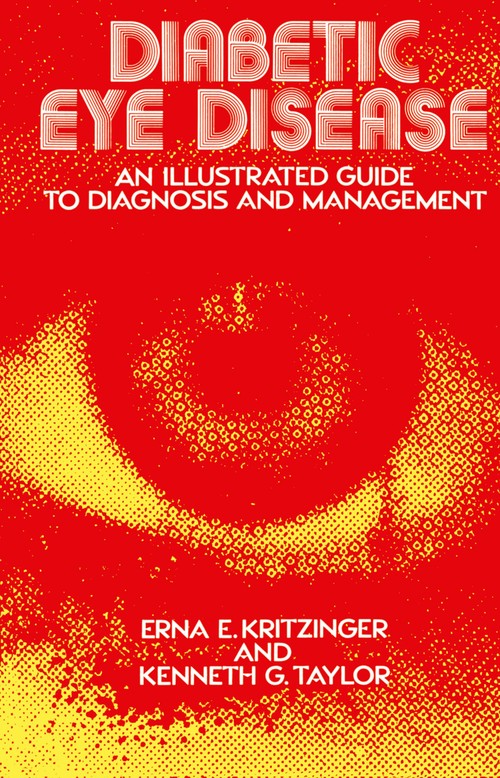 Diabetic Eye Disease by Ee Kritzinger | ISBN-13 9789401163460
