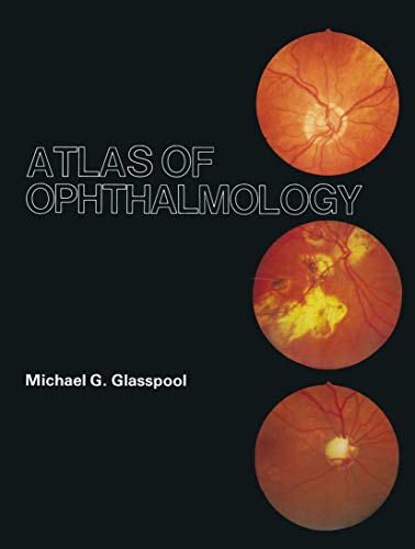 Atlas of Ophthalmology by Mg Glasspool | ISBN-13 9789401172615