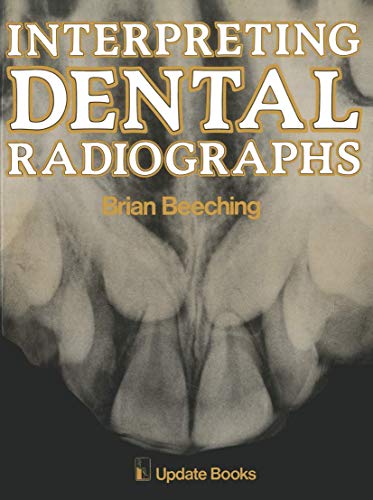Interpreting Dental Radiographs by Bw Beeching | ISBN-13 9789401180276