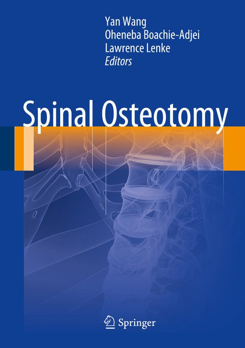 Spinal Osteotomy by Yan Wang | ISBN-13 9789401780377