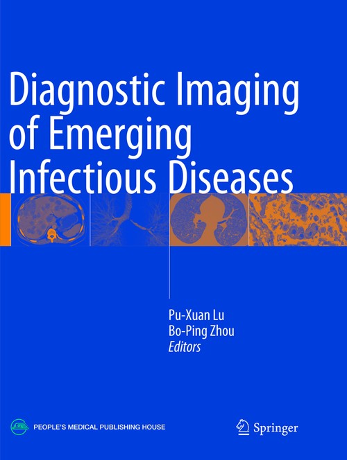 Diagnostic Imaging of Emerging Infectious Diseases by Pu-Xuan Lu ISBN 9789402413359