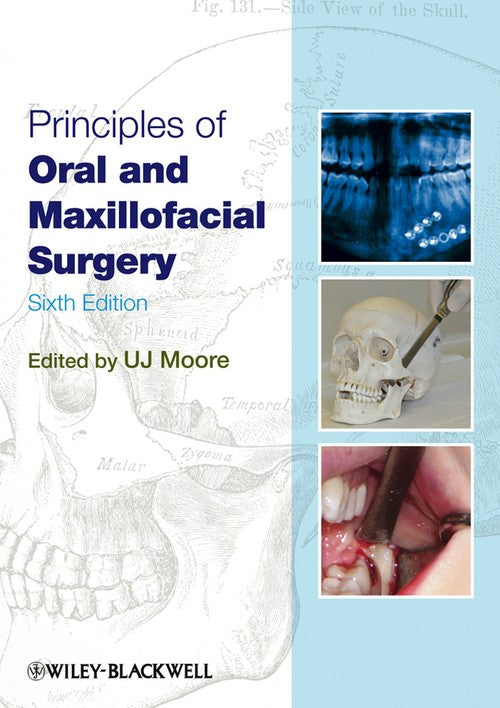 Principles of Oral and Maxillofacial Surgery by U J Moore ISBN 9781405199988