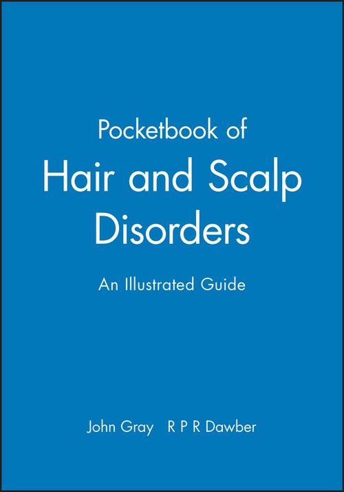 A Pocketbook of Hair and Scalp Disorders by John Gray ISBN 9780632051892